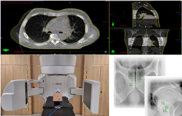 The Royal Marsden's IGART - Image Guided Adaptive Radiotherapy Course